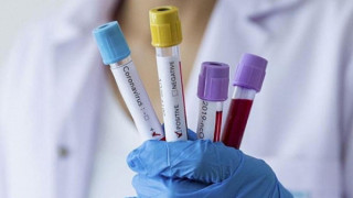 Доказано: Втора вълна на Ковид-19 у нас!