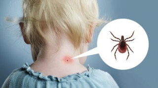 Столичани пропищяха: Кърлежи нападнаха ученик в Южния парк! (Лекарите извадиха от главата му 50 кръвопийци)