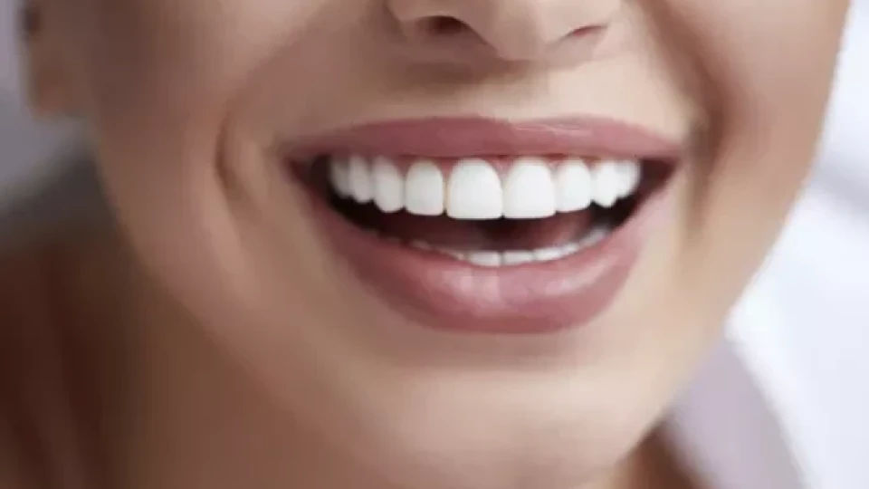 Най-доброто избелване на зъбите у дома! (разликата се вижда веднага, а и укрепва венците)