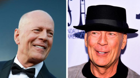 Жената на Брус Уилис с болка: Игнорирах този признак, но той предшестваше страшната диагноза!