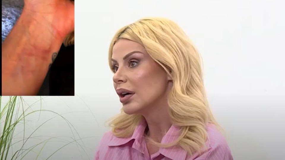 Пълна мистерия: Светлана Василева показа синини от боя, но не повдигна обвинение срещу гаджето! (Снимки)