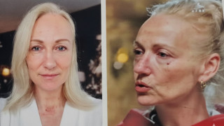 Мистерията на подмладяването: Платила ли е Неве за новото си лице?