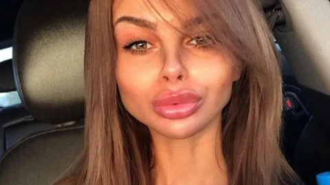 Сузанита се пусна с абокат в очакване на новата порция разкрасяване със скалпела